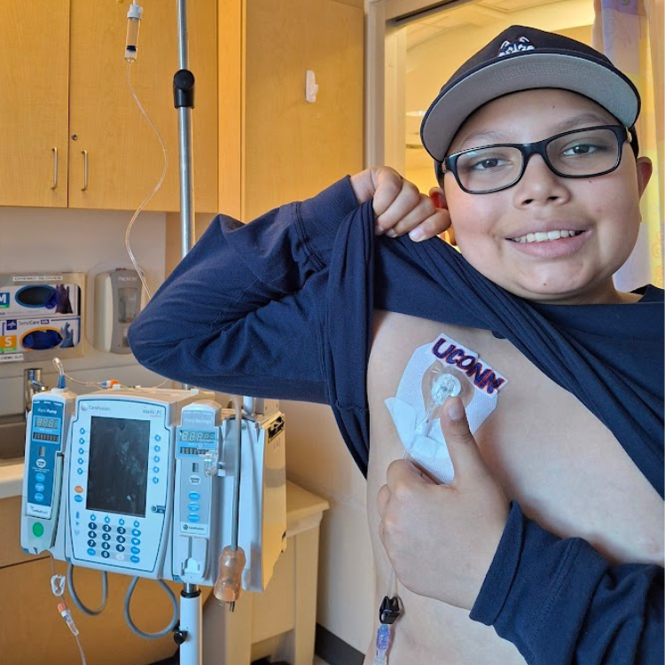 Elijah smiling with his chemo port labeled "UConn"