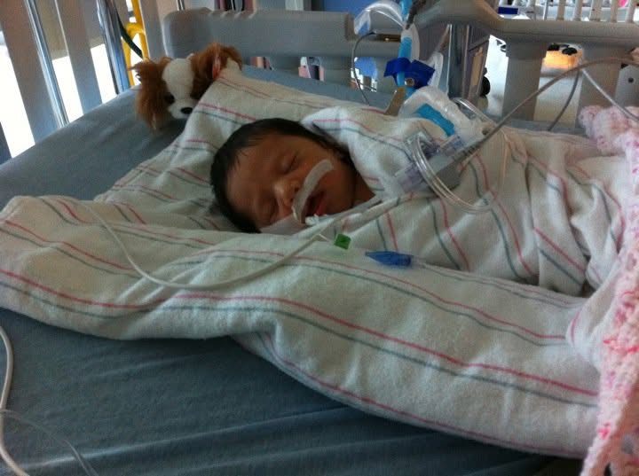 Jordyn as a baby after her surgery