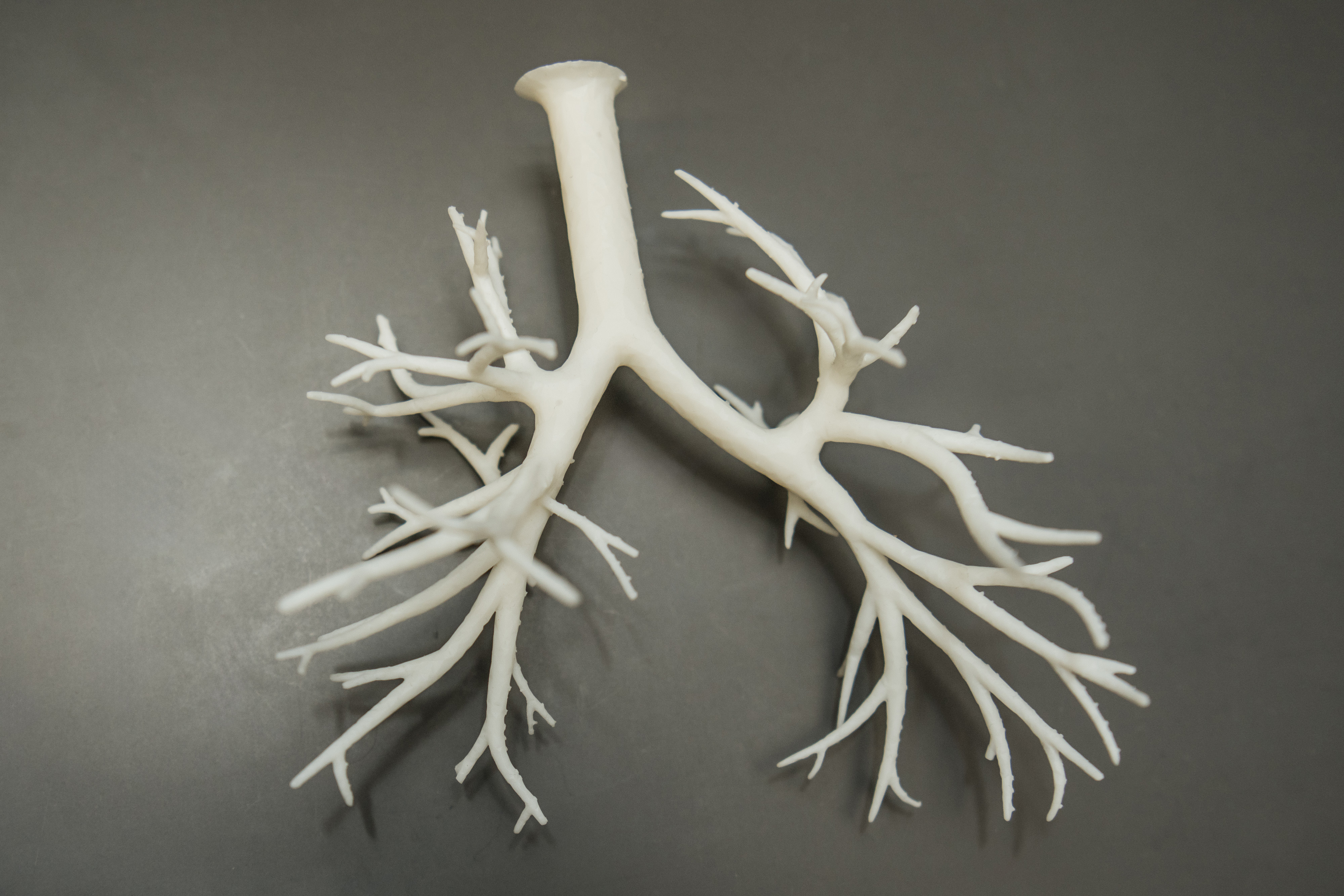 Bioprinted airways