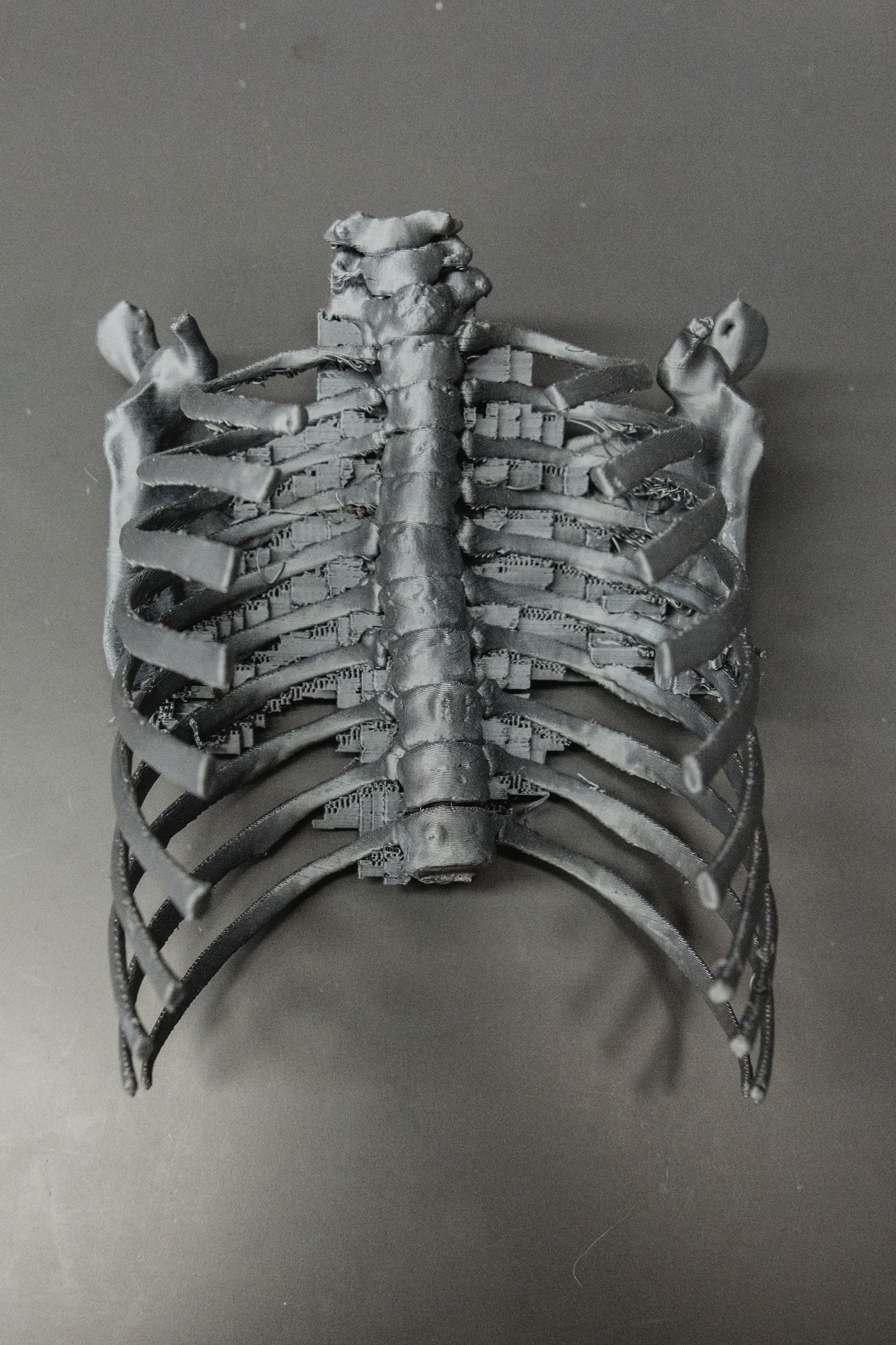 Bioprinted lungs
